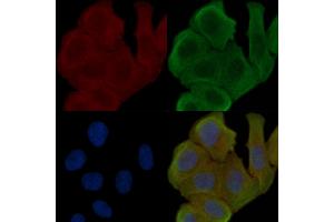 ABIN6255881 and ABIN6267618 staining Hela cells(30 min of UV treatment) by IF/ICC.