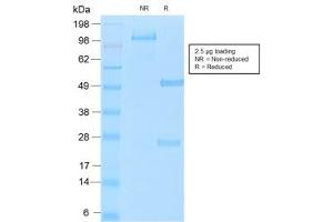SDS-PAGE analysis of purified, BSA-free recombinant MUC16 antibody (clone OCA125/2349R) as confirmation of integrity and purity.