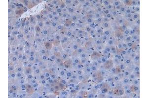 Detection of FN in Rat Liver Tissue using Polyclonal Antibody to Fibronectin (FN)