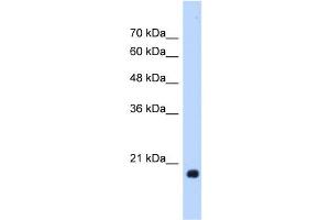WB Suggested Anti-HSPB6 Antibody Titration:  1.