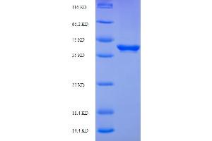SDS-PAGE (SDS) image for Butyrophilin, Subfamily 3, Member A2 (BTN3A2) (AA 30-248) protein (His-SUMO Tag) (ABIN5709155)