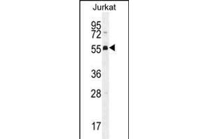 PODNL1 Antibody (Center) (ABIN656141 and ABIN2845479) western blot analysis in Jurkat cell line lysates (35 μg/lane). (PODNL1 anticorps  (AA 167-195))