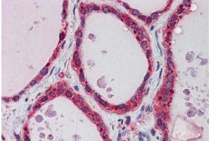 Human Thyroid: Formalin-Fixed, Paraffin-Embedded (FFPE)
