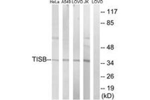 Western blot analysis of extracts from Jurkat/HeLa/A549/LOVO cells, using TISB (Ab-92) Antibody. (ZFP36L1 anticorps  (AA 58-107))