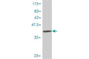 Western Blot detection against Immunogen (38.
