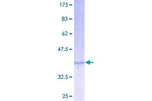 Image no. 1 for Interleukin 9 (IL9) (AA 1-144) protein (GST tag) (ABIN1307850)