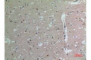 Immunohistochemistry (IHC) analysis of paraffin-embedded Human Brain, antibody was diluted at 1:100. (IL16 anticorps  (C-Term))