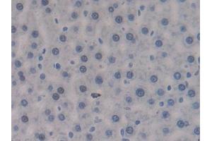IHC-P analysis of Rat Liver Tissue, with DAB staining. (PTPRJ anticorps  (AA 1033-1277))