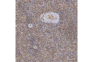 IHC analysis of SFXN3 using anti-SFXN3 antibody (ABIN7601302). (SFXN3 anticorps  (AA 32-321))