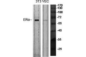 Western Blot (WB) analysis of specific cells using ERalpha Polyclonal Antibody. (Estrogen Receptor alpha anticorps  (Ser364))