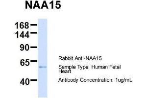 Host:  Rabbit  Target Name:  NAA15  Sample Type:  Human Fetal Heart  Antibody Dilution:  1. (NAA15 anticorps  (N-Term))