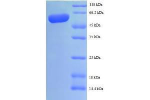 Interleukin 12b (IL12B) (AA 23-328), (full length) protein (GST tag) (IL12B Protein (AA 23-328, full length) (GST tag))