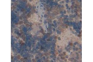 IHC-P analysis of Rat Tissue, with DAB staining. (TRADD anticorps  (AA 24-261))