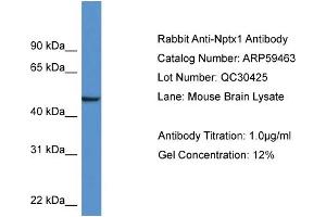Western Blotting (WB) image for anti-Neuronal Pentraxin 1 (NPX1) (Middle Region) antibody (ABIN786031) (NPX1 anticorps  (Middle Region))