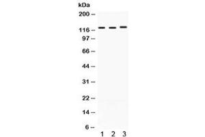 Western blot testing of 1) rat heart, 2) mouse brain, and 3) human A549 lysate with CRM1 antibody. (XPO1 anticorps)