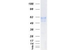 Validation with Western Blot