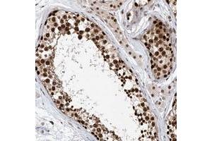 Immunohistochemical staining of human testis with ZNF470 polyclonal antibody  shows strong nuclear positivity in cells of seminiferus ducts.