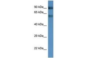 Image no. 1 for anti-Solute Carrier Family 6 (Neutral Amino Acid Transporter), Member 15 (SLC6A15) (AA 400-449) antibody (ABIN6746236) (SLC6A15 anticorps  (AA 400-449))