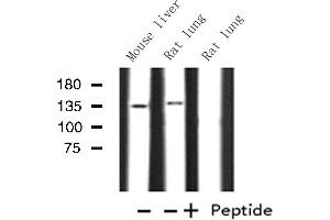 Western blot analysis of Histone KPB1/2 expression in various lysates (KPB1/2 anticorps)