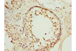 Immunohistochemistry of paraffin-embedded human testis tissue using ABIN7166136 at dilution of 1:100 (CCDC99 anticorps  (AA 1-300))