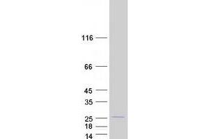 Validation with Western Blot