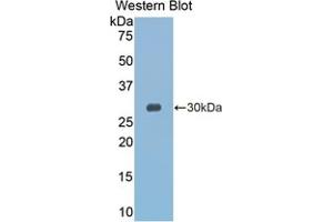 Western blot analysis of the recombinant protein. (GZMK anticorps  (AA 27-264))