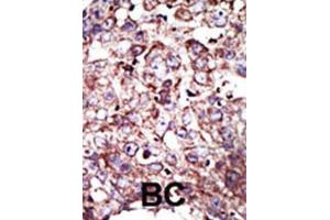 Immunohistochemistry (IHC) image for anti-Farnesyltransferase, CAAX Box, alpha (FNTA) antibody (ABIN3001525) (FNTA anticorps)