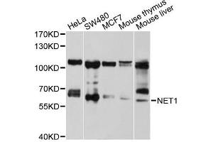 Western blot analysis of extracts of various cell lines, using NET1 antibody (ABIN5970555) at 1/1000 dilution. (NET1 anticorps)