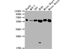 Western Blot Positive WB detected in: HepG2 whole cell lysate, MCF-7 whole cell lysate, 293 whole cell lysate, HL60 whole cell lysate, Mouse Heart tissue, Mouse Brain tissue All lanes: ATP5F1A antibody at 1:2000 Secondary Goat polyclonal to rabbit IgG at 1/50000 dilution Predicted band size: 60, 55, 58 kDa Observed band size: 60 kDa