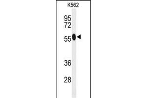 Western blot analysis of ACSM1 Antibody (N-term) (ABIN653232 and ABIN2842765) in K562 cell line lysates (35 μg/lane). (ACSM1 anticorps  (N-Term))