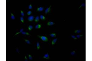 Immunofluorescence staining of Hela Cells with ABIN7127338 at 1:50, counter-stained with DAPI.