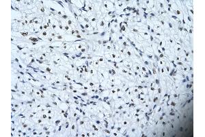 Rabbit Anti-HIPK2 Antibody       Paraffin Embedded Tissue:  Human cardiac cell   Cellular Data:  Epithelial cells of renal tubule  Antibody Concentration:   4. (HIPK2 anticorps  (Middle Region))
