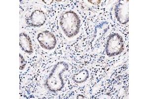IHC analysis of ADK using anti-ADK antibody (ABIN4886430). (ADK anticorps  (AA 165-351))