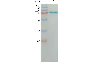 Human SA Protein, His Tag on SDS-PAGE under reducing condition.