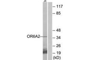 Western blot analysis of extracts from Jurkat cells, using OR6A2 Antibody.