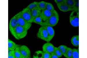 MCF-7 cells were stained with ERK5 (8D8) Monoclonal Antibody  at [1:200] incubated overnight at 4C, followed by secondary antibody incubation, DAPI staining of the nuclei and detection.