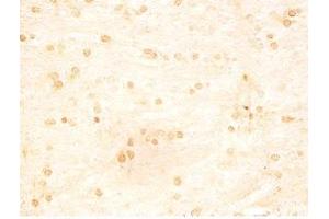 Rat brain tissue was stained by Rabbit Anti-INSL5 C Peptide (49-106) (Human) Serum (INSL5 anticorps  (Preproprotein))