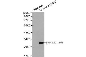 Western blot analysis of extracts from Hela cells using Phospho-BCL2L1-S62 antibody.