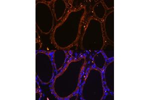 Immunofluorescence analysis of Rat thyroid using WNT5A Rabbit pAb (ABIN6134458, ABIN6150248, ABIN6150249 and ABIN6216485) at dilution of 1:100.
