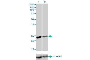 Western blot analysis of RAB4A over-expressed 293 cell line, cotransfected with RAB4A Validated Chimera RNAi (Lane 2) or non-transfected control (Lane 1).