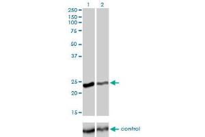 Western blot analysis of RAB4A over-expressed 293 cell line, cotransfected with RAB4A Validated Chimera RNAi (Lane 2) or non-transfected control (Lane 1). (Rab4 anticorps  (AA 1-218))