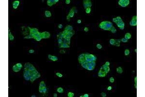 Immunofluorescent staining of HepG2 cells using anti-SORD mouse monoclonal antibody (ABIN2453678). (SORD anticorps)