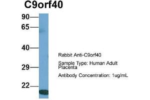 Host: Rabbit  Target Name: C9orf40  Sample Tissue: Human Adult Placenta  Antibody Dilution: 1. (C9orf40 anticorps  (Middle Region))
