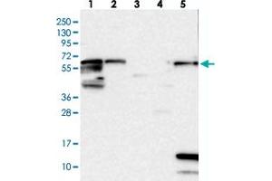 Western blot analysis of Lane 1: RT-4, Lane 2: U-251 MG, Lane 3: Human Plasma, Lane 4: Liver, Lane 5: Tonsil with ME3 polyclonal antibody . (ME3 anticorps)