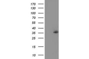 Western Blotting (WB) image for anti-Nudix (Nucleoside Diphosphate Linked Moiety X)-Type Motif 6 (NUDT6) antibody (ABIN1499871) (NUDT6 anticorps)