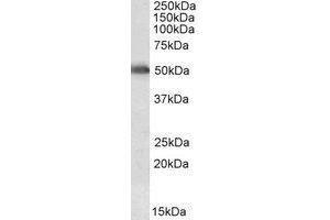 Western Blotting (WB) image for anti-Cytochrome P450, Family 2, Subfamily E, Polypeptide 1 (CYP2E1) (AA 233-243) antibody (ABIN1493874)
