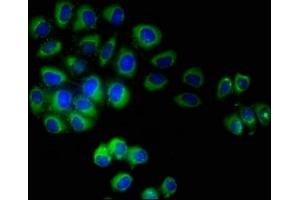 Immunofluorescent analysis of A549 cells using ABIN7173087 at dilution of 1:100 and Alexa Fluor 488-congugated AffiniPure Goat Anti-Rabbit IgG(H+L) (TMEM161B anticorps  (AA 1-487))