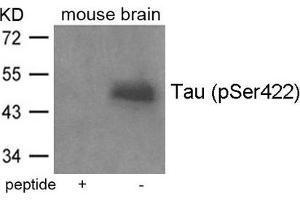 Western blot analysis of extracts from mouse brain tissue using Tau(Phospho-Ser422) Antibody and the same antibody preincubated with blocking peptide. (MAPT anticorps  (pSer422))
