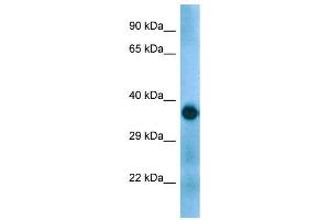 Host:  Rabbit  Target Name:  Gapdh  Sample Type:  Mouse Muscle lysates  Antibody Dilution:  1. (GAPDH anticorps  (C-Term))