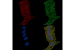 ABIN6265360 and ABIN6276804 staining Hela cells(24h of starvation treatment) by IF/ICC. (TAC1 anticorps  (N-Term))